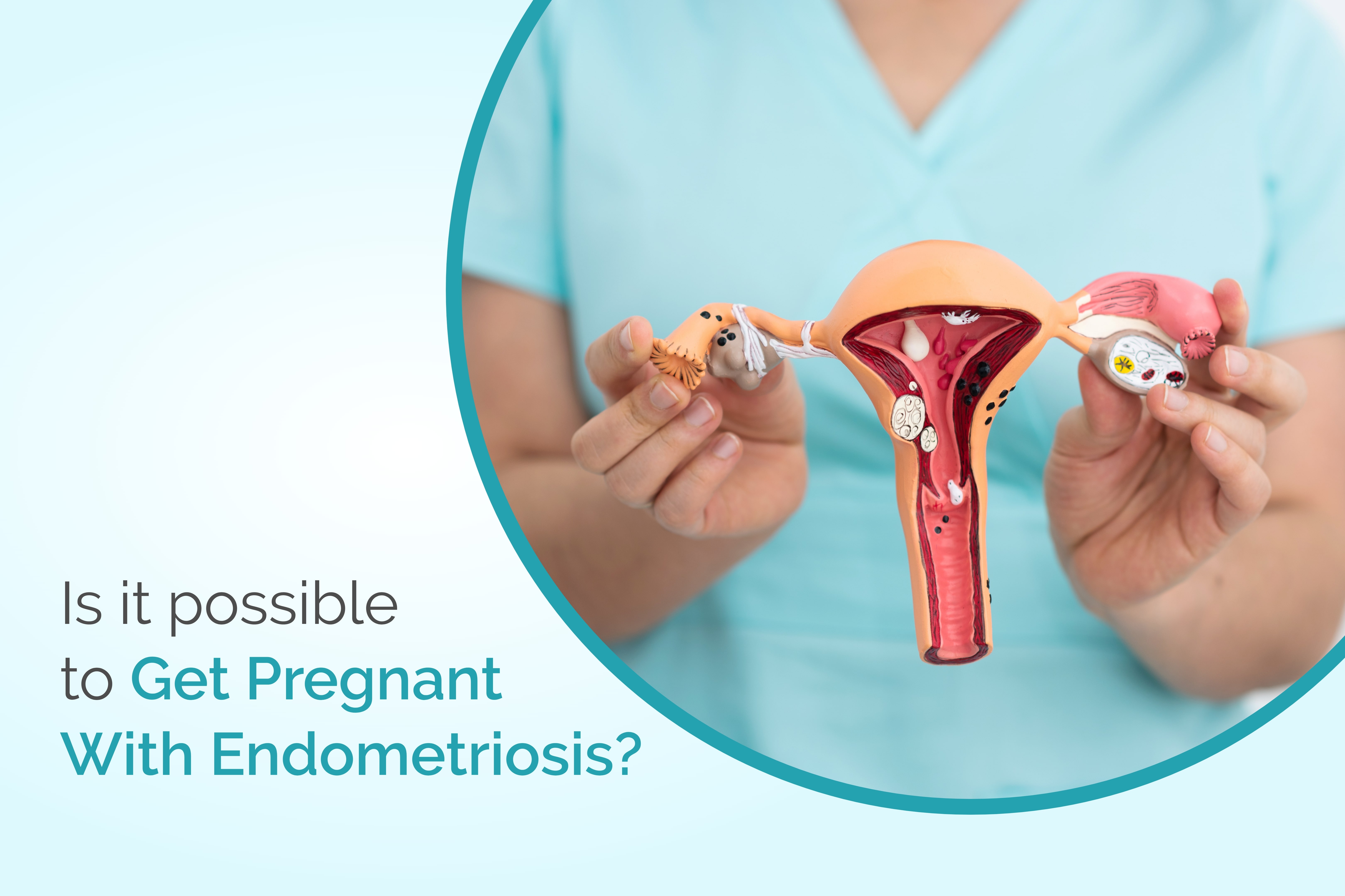 Is It Possible To Get Pregnant With Endometriosis?