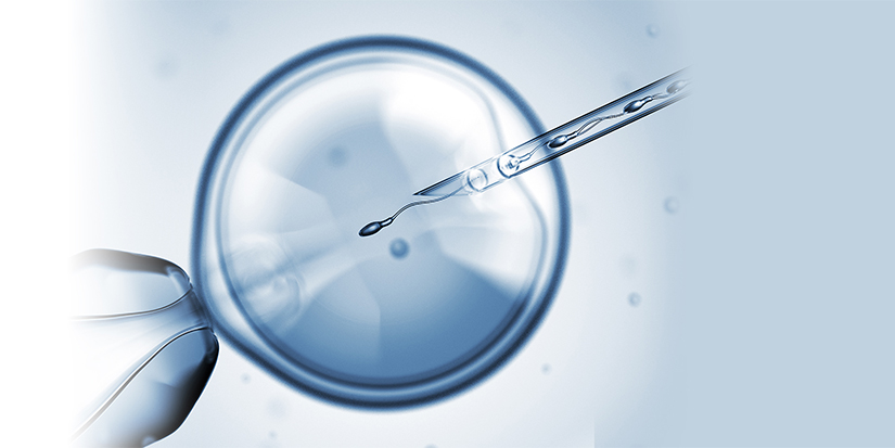How-Does-ICSI-Treatment-in-Hyderabad-Help-Couples-Overcome-Infertility?