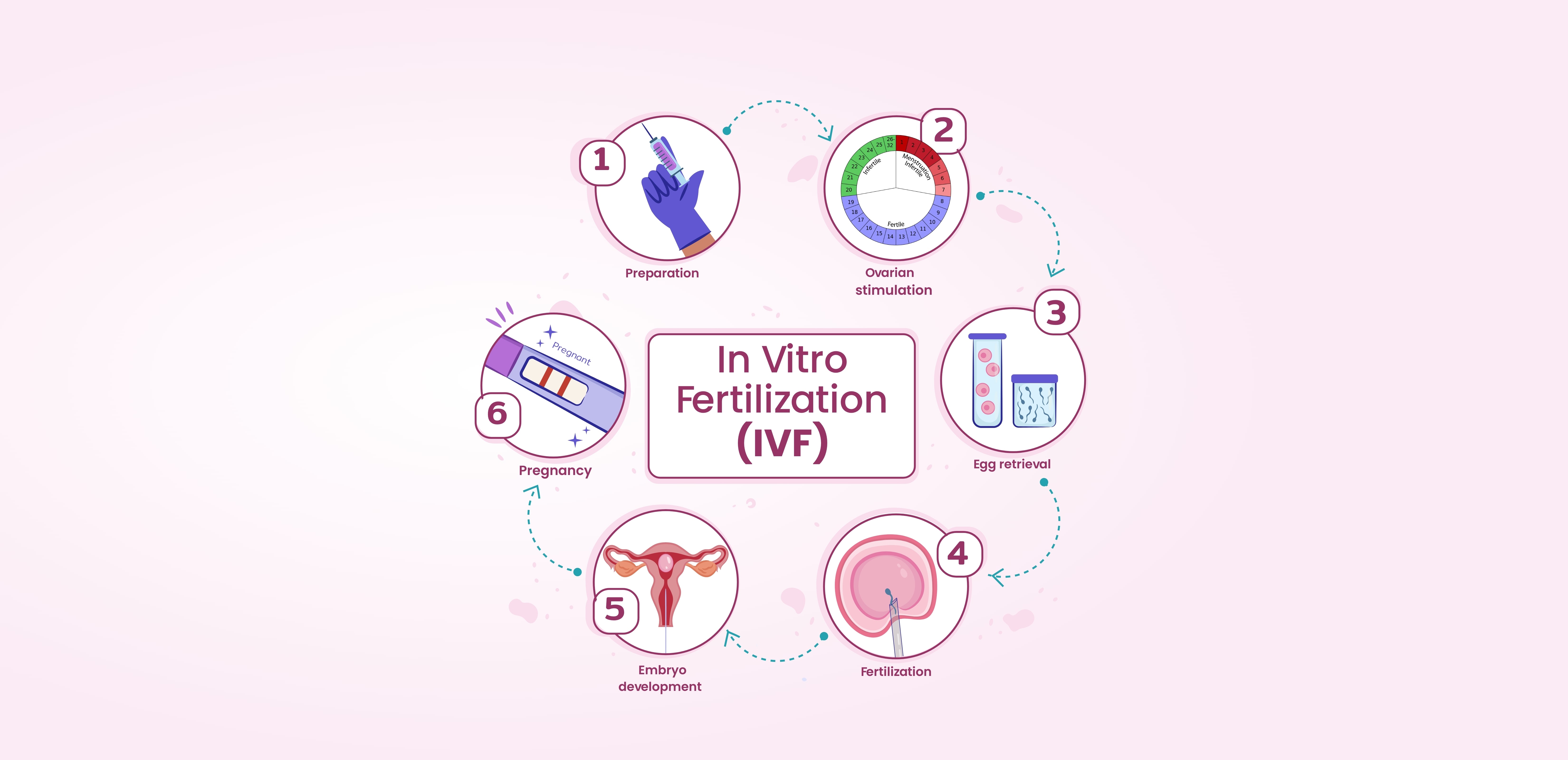 In Vitro Fertilization:What Makes IVF at Juhi Clinic Different?