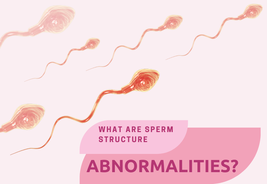What are Sperm Structure Abnormalities?