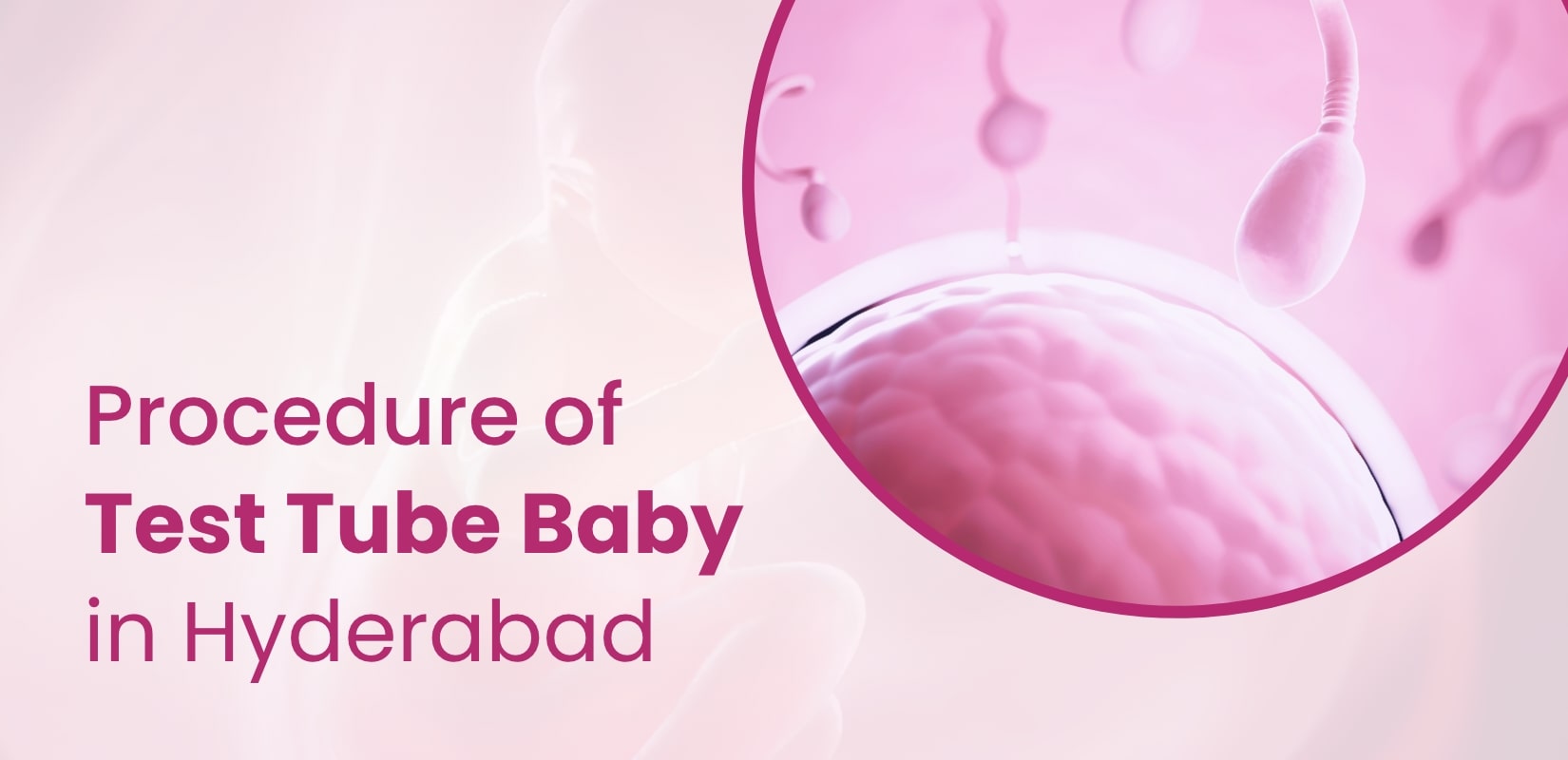 Procedure of Test Tube Baby Hyderabad  