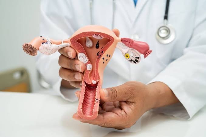 endometriosis-and-ivf-what-you-need-to-know-before-treatment