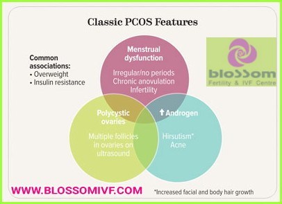 PCOS FEATURES