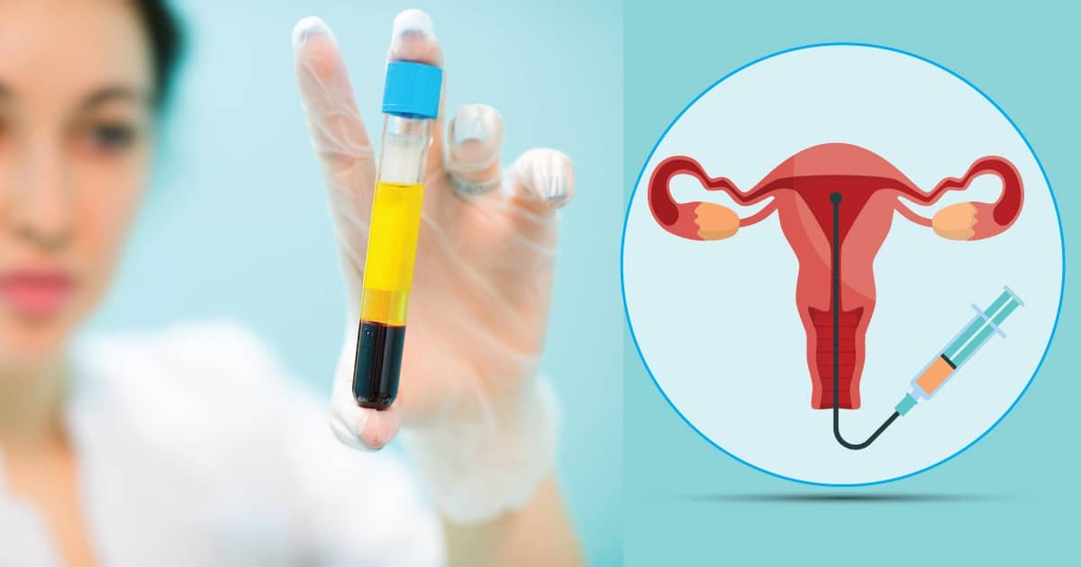 prp-ivf-treatment-in-hyderabad-how-platelet-rich-plasma-can-improve-fertility-outcomes