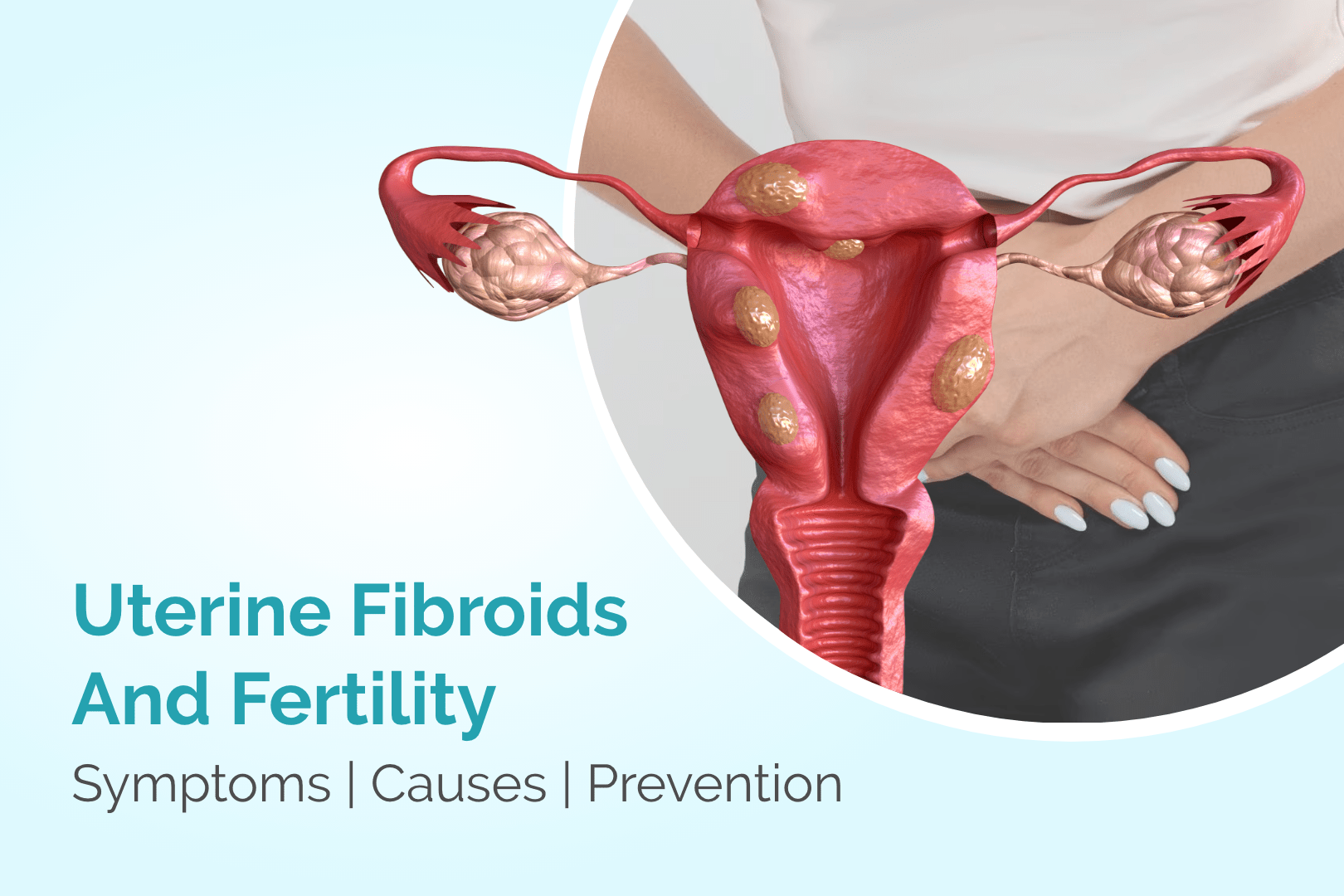 Uterine Fibroids And Fertility: Symptoms, Causes, Prevention