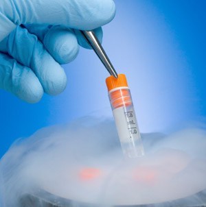 Embryo Vitrification in Hyderabad