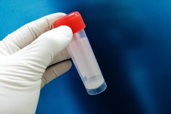 zero-sperm-count-what-causes-it-and-how-can-it-be-treated
